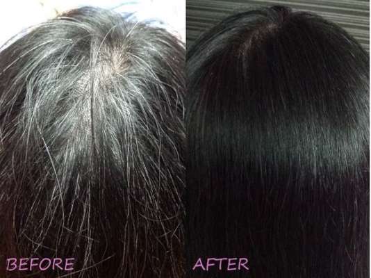 Turn Your White Hair Into Black Completety In 1 Week Use This