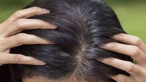 Hair Turning Grey Try These Five Natural Home Remedies