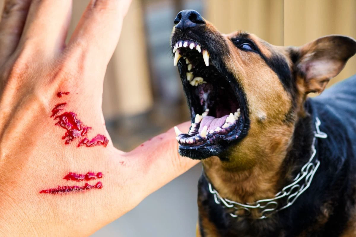 रेबीज से मौत का खतरा! सिर्फ कुत्ता-बिल्ली ही नहीं, इन 5 जानवरों के काटने पर तुरंत लगवाएं टीका