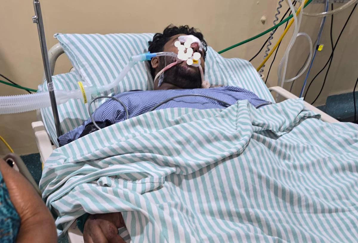 BBMP ಅಧಿಕಾರಿಗಳ ನಿರ್ಲಕ್ಷ್ಯ: ಸಾವು ಬದುಕಿನ ಹೋರಾಟದಲ್ಲಿ ಯುವಕ- ಅಂತದ್ದೇನಾಯ್ತು?