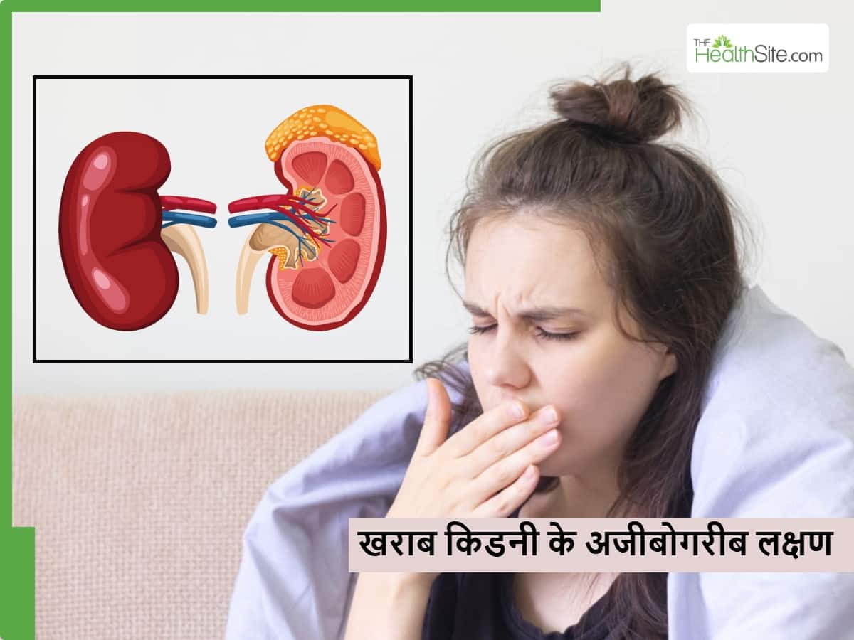 किडनियां खराब होते ही दिन भर महसूस हो सकते हैं ये 5 लक्षण, 10 में 8 लोग नहीं समझ पाते इन्हें