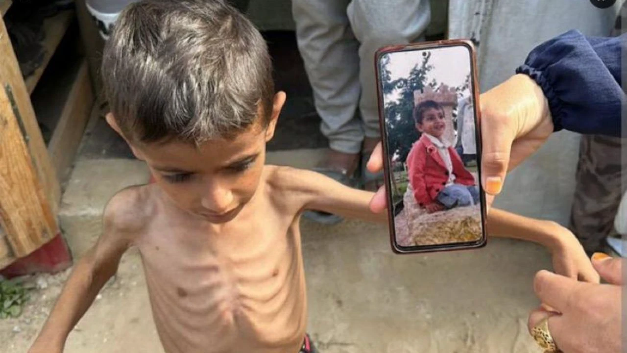 ‘दर्द से कराहते बच्चे, दर्द निवारक दवा नहीं’, गाजा से भयावह तस्वीरें ‘दर्द से कराहते बच्चे, दर्द निवारक दवा नहीं’, गाजा से भयावह तस्वीरें