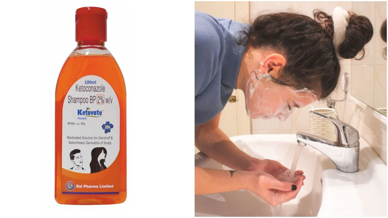 ব্রণ সারাতে খুশকির শ্যাম্পু ব্যবহার করলে আপনার ত্বকের কী মারাত্মক ক্ষতি হতে পারে