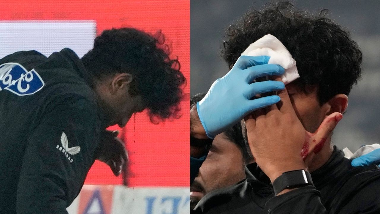 Video: आंख में लगी बॉल, खून से लथपथ हुआ स्टार खिलाड़ी, Live मैच में दर्दनाक हादसा