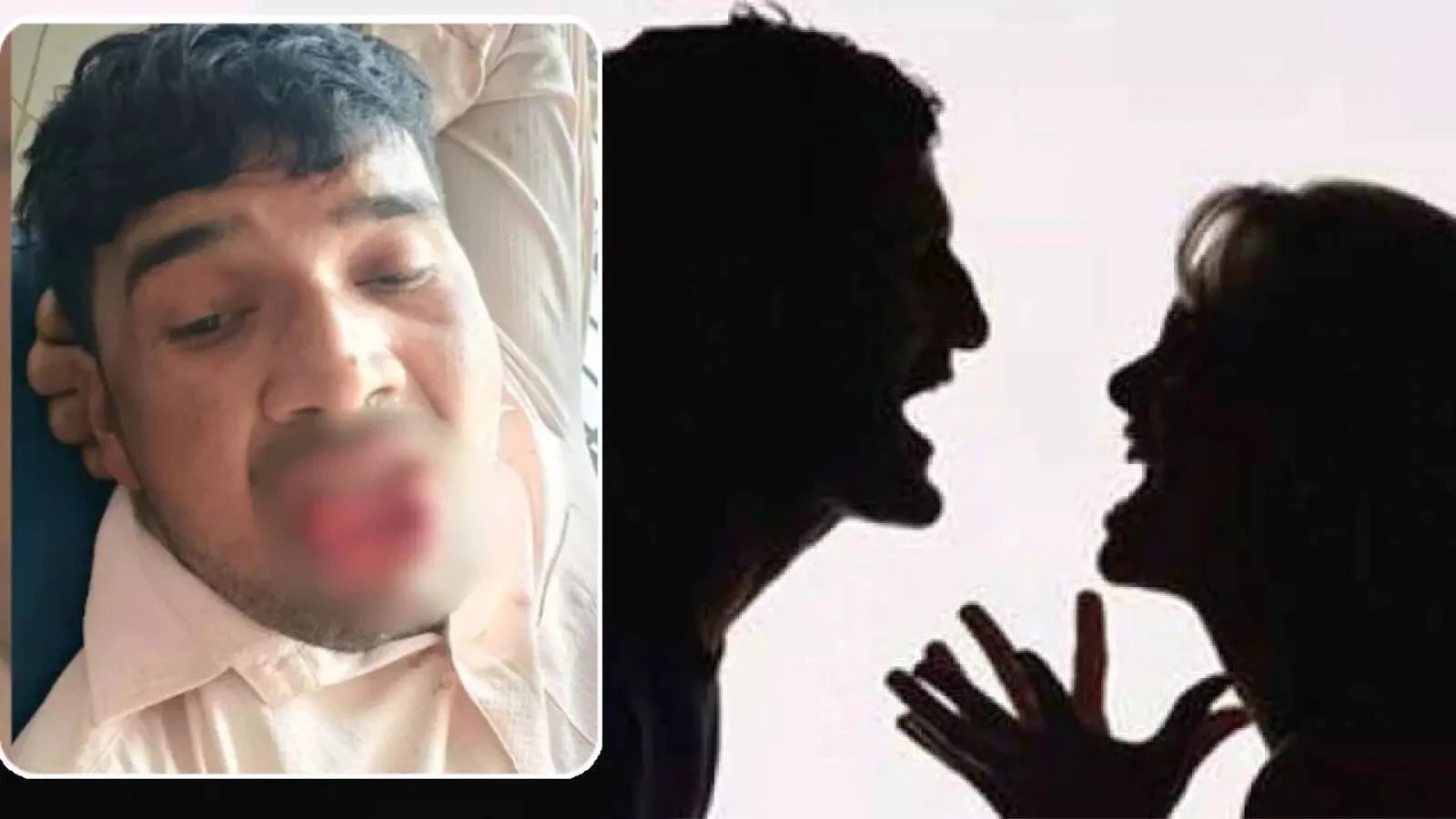 एक्स-गर्लफ्रेंड को जबरन किस करने की कोशिश, गुस्साई युवती ने दांत से काट डाली जीभ, FIR दर्ज!