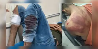 Two Muslim youths allegedly attacked in Shamshabad; Police say it was a clash between two groups