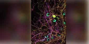 Body fights flu and COVID, but the price it pays may be a Parkinson's risk