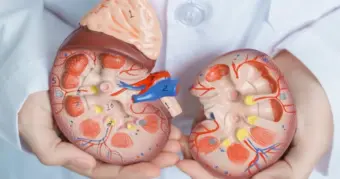 Urologist Shares Facts On Calcium Supplements And Kidney Stone Formation