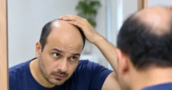 सिर्फ 1 महीने तक सरसों के तेल में मिलाकर लगाएं ये चीज! बाल झड़ने से मिलेगी राहत? गंजेपन पर दावे ने मचाई हलचल