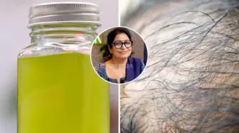 गंजे सि‍र पर भी उग आएंगे नए बाल, ये तेल है लाजवाब, जान लें लगाने का तरीका