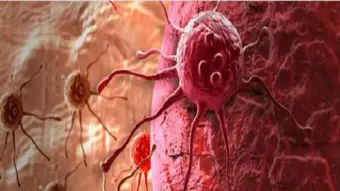 Ultrasound May Selectively Attack Cancer Cells, IISc Study Finds