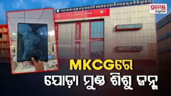 Conjoined Head Baby: ବ୍ରହ୍ମପୁର MKCG ମେଡିକାଲରେ ବିରଳ ଯୋଡ଼ା ମୁଣ୍ଡ ଶିଶୁ ଜନ୍ମ, ନବଜାତର ଅବସ୍ଥା ଗୁରୁତର