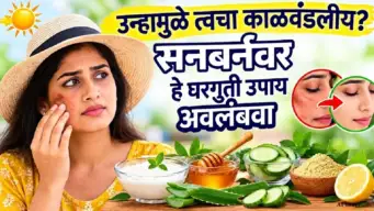 उन्हामुळे त्वचा काळवंडलीय? सनबर्नवर हे ५ घरगुती उपाय अवलंबवा