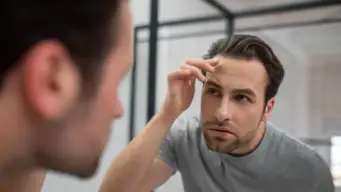 National Hair Day: A dermatologist explains why men are experiencing hair loss in their 20s and 30s.