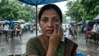 Why Does Eye Flu Spike Every Monsoon? An Eye Specialist Explains What's Behind It