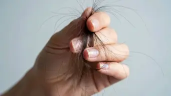 Humidity In Monsoon Increases Hair Fall, This Oil Can Help Prevent It