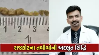 મેડિકલ મિરેકલ! રાજકોટમાં 18 વર્ષના યુવકની લાળની નળીમાંથી એકસાથે 10 પથરી કઢાઈ, એ પણ ચહેરા પર કોઈ ડાઘ વગર