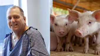 Pig kidney keeps 66-year-old man off dialysis for 9 months before human transplant in world's first