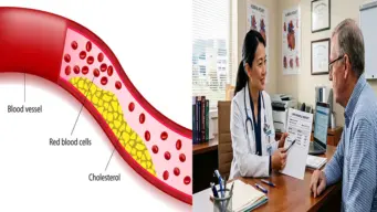 High Cholesterol : हाई कोलेस्ट्रॉल की बीमारी क्यों होती है, कौन सी गलतियां इसका कारण हैं?