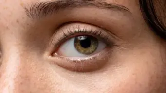 What Does Left Eye Twitching Mean for Women? Here's What Astrology Says