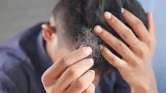 PM2.5 may damage more than lungs: Experts warn air pollution could trigger hair loss