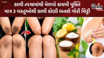 Dark Elbows Treatment: કોણી અને ઘૂંટણની કાળી પરત થશે ગાયબ! બ્યૂટી એક્સપર્ટનો અક્સીર નુસખો