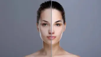 Home Remedies For Uneven Skin Tone And How To Use Them