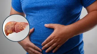 ഗ്രേഡ് 1 ഫാറ്റി ലിവര്‍ രോഗം തിരിച്ചറിഞ്ഞ ശേഷം എന്ത് ചെയ്യണം?