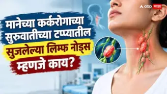 Neck Cancer News : मानेच्या कर्करोगाच्या सुरुवातीच्या टप्प्यातील सुजलेल्या लिम्फ नोड्स म्हणजे काय?