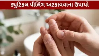 નખની આસપાસથી ચામડી ઉખડે છે? જાણો તેના કારણો અને બચવાના સરળ ઉપાયો