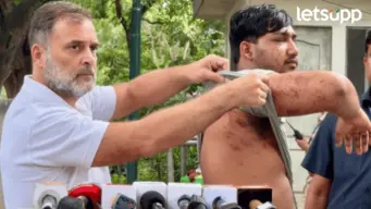 आंदोलनादरम्यान विद्यार्थ्यांवर पॅलेट गनने हला केला?, विद्यार्थ्याचं शर्ट काढून दावखवत राहुल गांधींचा सरकारवर घणाघात