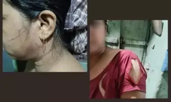 West Bengal woman alleges assault, forced religious conversion by Bajrang Dal-linked group