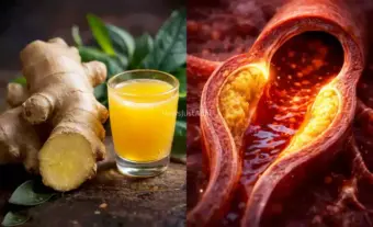 हार्ट ब्लॉकेज​​ खोलने की सबसे अच्छी और सबसे सच्ची अद्भुत जड़ी-बूटी, परिणाम आप खुद बताओगे हमे, जरूर पढ़े