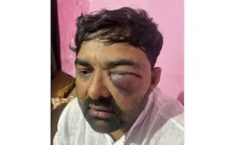 उत्तर प्रदेश: किसान नेताओं का मेरठ पुलिस पर हिरासत में यातना देने का आरोप, जांच के आदेश