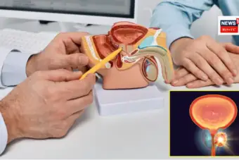 Prostate Cancer: పురుషుల్లో పెరుగుతున్న ఈ క్యాన్సర్.. 84% మందికి స్క్రీనింగ్‌పై అవగాహన లేదట!