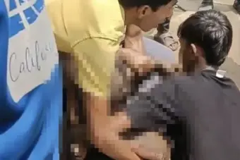 Guwahati Man Injured After Coming Into Contact With High-Voltage Wire
