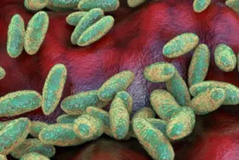 Bubonic Plague : লোভ ডেকে আনল নতুন বিপদ! মাংস মুখে দিতেই ঘাড়ে বড় বড় গাঁট, 'ব্ল্যাক ডেথ' মহামারির আতঙ্ক ফিরল আবার