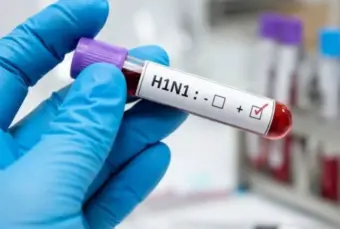 H1N1 ମାମଲା ବଢ଼ିଲା, ଦିଲ୍ଲୀରେ ସ୍ୱାଇନ୍ ଫ୍ଲୁ ଆଲର୍ଟ