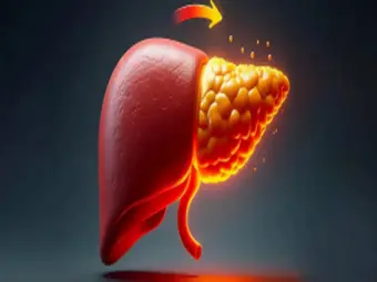 4 home remedies for fatty liver are hidden in grandmother's kitchen, know how to use them?