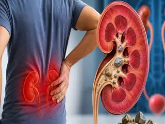 Kidney stone prevention: किडनी स्टोन से कैसे बचें? यह छोटी सी गलती बन जाती है बड़ी बीमारी का कारण