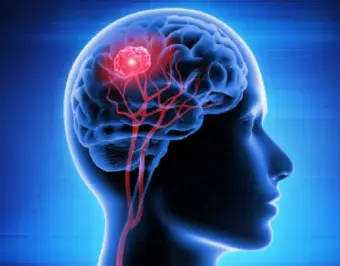 Brain tumors: New vaccine offers patients hope for more time