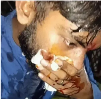 বিপুল সংখ্যক বিক্ষোভকারী কলকাতার ডোরিনা ক্রসিং জওহরলাল নেহরু রোড ও রানি রাসমণি অ্যাভিনিউ মোড়)-এ পুলিশের অনুমতি ছাড়াই জমায়েত করেন