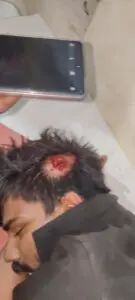 యువకుడిపై కర్రలతో దాడి.. పరిస్థితి విషమం