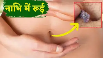 नाभि में रूई क्यों आती है, आपके साथ भी आ रही समस्या तो करें ये उपायˌ “ ˌ नाभि में रूई क्यों आती है, आपके साथ भी आ रही समस्या तो करें ये उपायˌ “ ˌ