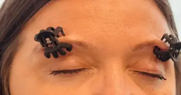 AIIMS-Trained Neurologist Evaluates Six Popular Migraine Hacks For Effectiveness
