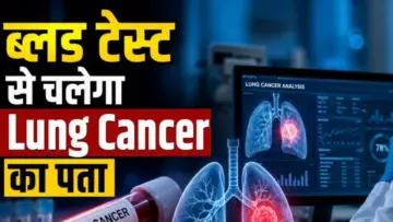 Lung Cancer Detection में बड़ा ब्रेकथ्रू, ब्लड टेस्ट से 5 साल पहले ही चल जाएगा फेफड़ों के कैंसर का पता