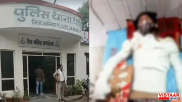 ग्वालियर में बदमाश ने युवक पर पेट्रोल छिड़ककर लगाई आग, 60 प्रतिशत झुलसा, बेटे को बचाने में पिता भी गंभीर घायल