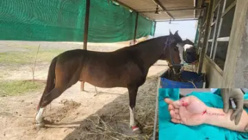 Surat: NRI's thumb severed while feeding a horse carrots, doctors saved it after four hours of microsurgery