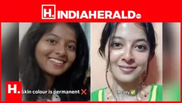 From Dusky to White in One Post: The Dangerous Truth No Skincare Routine Can Explain