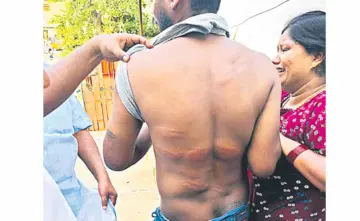 బ్యానర్‌ చించాడని యువకుడిపై థర్డ్‌ డిగ్రీ